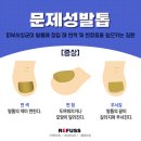 레푸스(REFUSS)
