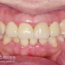 유어스치과병원 네이버블로그