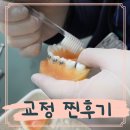 강서구-30 | 강서구교정치과 30대 화곡역치아교정 진심 리얼한 후기