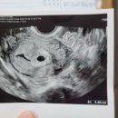 강동구보건소 화장실 이미지