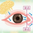 Dry Eye 눈물과 증상의 관계, 치료를 해설 이미지