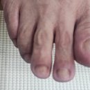 문외동 | 영천 문외동 발톱무좀 케어 만족 재은네일뷰티 페디크루 영천점