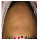 하늘토엠디한의원 이미지