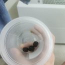 담석증수술 후기
