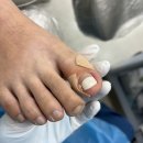 파리바게뜨구로항동점 | 푸스케어 구로항동점 철산역 내성발톱 발톱무좀