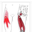 Vastus Intermedius (중간광근) 이미지