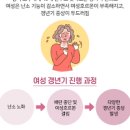 에스트로겐 부족 증상 여성 갱년기 영양제 스토그라 이미지