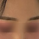 블리즈미