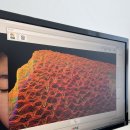 JS메디컬센터(블랙야크건물) | 울산 피부관리 추천! 데자뷰 메디스킨 울산점 저주파 v라인 윤곽 리프팅 후기