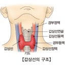 갑상선 미분화암 이미지