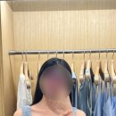 김형진베이직성형외과의원 | 승모근 보톡스 200유닛 세달 경과 후기 : 통증 ｜불편했던 점 ｜비포애프터 사진