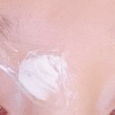 부산첫회 | 부산 여드름흉터치료 위너홀 새살침 2회차 기록 후기