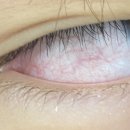 아이민트안과의원 이미지