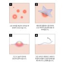 오오티디(OOTD) | 별모양 여드름패치 뾰꾸 스팟패치 후기 | OOTD뷰티 스타스팟패치 올리브영 구매 꿀팁