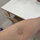 연세지아이내과 네이버블로그