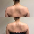 양덕동202 | 마산피부관리 양덕동 온본에스테틱에서 신부관리 받은 후기