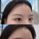 펌클린 | 동탄 브로우리프트펌 후기 반송동 눈썹문신 잘하는곳 <새로이채움> 자연눈썹 헤어스트록