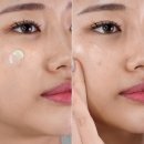 365그린약국 | 갑자기 올라온 볼 여드름 없애는법 모태 지성러가 알려줌