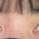 팝성형외과의원 이미지