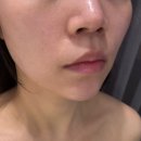 라효 | [별내피부관리] 프라이빗 피부 힐링룸 '라효'