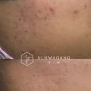 피부를 말하다 이미지