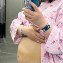 한마음정신병원 | [한마음병원 출산후기] 유도분만하다 결국 제왕절개.. 입원부터 퇴원까지, 리얼 일주일 기록