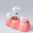 서울수려한치과병원 이미지