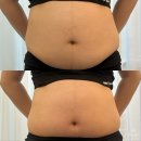 동안평생교육센터 | 의정부체형관리 가꾸는동안&amp;숲칼프 의정부교육센터 방문후기