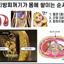 포레스트 다이어트 이미지