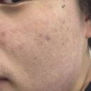 대흥종합기계 | [서울/공덕] <피부보기(skin biew)> 페이스관리 후기 💆‍♀️ | 공덕 피부관리 전문점 수분관리 솔직후기...