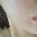 수원역예쁨주의쁨의원 | 수원) “수원역 쁨의원” 에서 받은 리들부스터 PN 2cc 후기 / 통증 / 효과 •• 💬