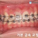 나은치과기공소 이미지