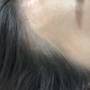두피채움연구소