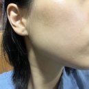 의정부오일서비스 | ✨ [의정부 피부관리] 셀티션 : 세라링 권위자 선생님께 받은 통증 없는 압출과 스케일링 후기 ✨