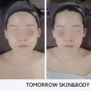 관리 투모로우스킨엔바디, 작은 얼굴 v라인 윤곽관리 받고 온 찐 후기, 인천 효성동 에스테틱 맛집 추천"