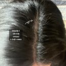 해솔유명약국 | 파주피부과_운정 세솔메디컬 피부과_습진,피부염,두피가려움