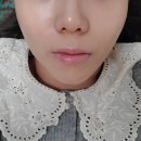 강남스킨플래닝, 선릉역 로라뷰티살롱에서 물광피부 만들어봐요(화장잘먹는 꿀팁!)