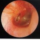 포낙보청기수원센터 이미지