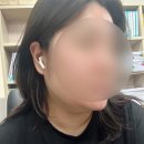 닥터쁘띠의원 | 닥터쁘띠의원(대전점) / 내돈내산 / 피부시술 후기 / 이중턱개선 / 인모드 FX 1부위 3회권