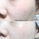 걱정되는 내 피부 관리★ 블로거 네일리아님과 함께한 에이씨케어 워터 에센스 집중탐구 !