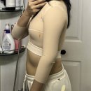 멍클린 | 출산후 다이어트 대구 팔뚝지방흡입 수술당일~3일차 후기! (+멍,붓기,통증,압박복)