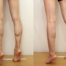 뉴슬림의원 | $30. 종아리 성형과 심리학: 환자 기대치 관리의 과학적 접근 - 세이지의원
