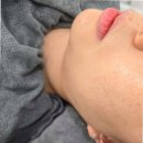지원코스메틱 | 김은영코스메틱 마포피부관리 이용 후 피부 변화