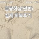 썬번 | 일광화상 썬번 후기｜2시간 만에 피부 화상? 회복 기간과 치료 방법까지 솔직 후기