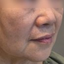 수로왕릉역 | 김해 수로왕릉역 피부과 스킨부스터 잘하는곳 셀르디엠 김해 피부과 선택이유