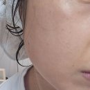 쇼핑몰(화장품판매) | 피부과 판매 여드름 화장품 _ 아크니케어 로션 후기