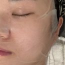 수성구 피부관리 잘하는 곳, 심스킨 윤곽수기관리 + 데콜테 관리 후기