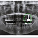 정치과기공소 이미지