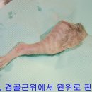 비경골 원위골절-고양이-별이 이미지