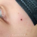 역삼-1513 | 점문신 역삼 미인점 갈색점으로 자연스럽게 한 후기